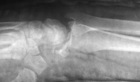 Upper Extremity 2026 MCQs: Board Review Questions & Answers (Part 5) - Figure 17