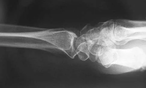 Upper Extremity 2026 MCQs: Board Review Questions & Answers (Part 5) - Figure 25