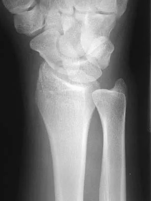 Upper Extremity 2026 MCQs: Board Review Questions & Answers (Part 5) - Figure 3