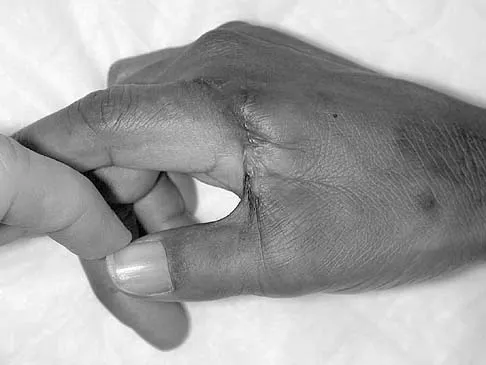 Upper Extremity 2026 MCQs: Board Review Questions & Answers (Part 5) - Figure 35