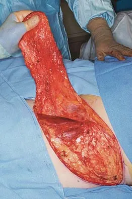 Upper Extremity 2026 MCQs: Board Review Questions & Answers (Part 5) - Figure 41