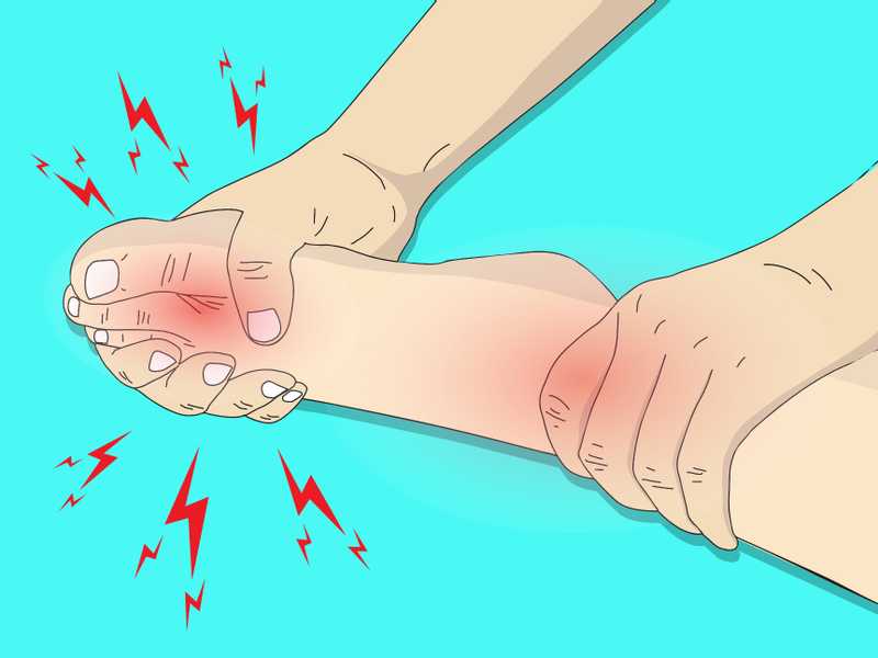 النقرس الكاذب