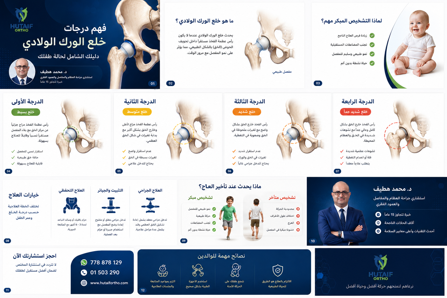 صورة توضيحية لـ الخلع الوركي النمائي (DDH) ودليل شامل لأمراض الورك