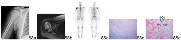 Orthopedic Pathology MCQs 011: Decipher What's Seen in Figures