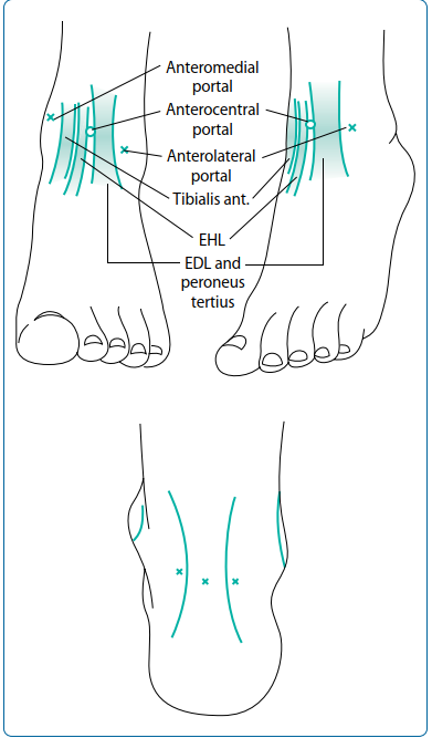 Illustration of postoperative care and instructions - Dr. Mohammed Hutaif