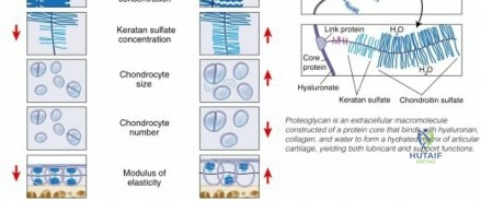 Illustration of cartilage and joint - Dr. Mohammed Hutaif