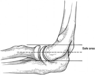 Illustration 108 for Right Shoulder Pain? Avoid This Common X-ray Mistake.