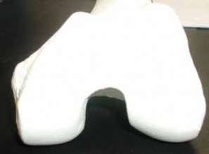 Complex Distal Femur Fractures: See the patient in figure's solution.