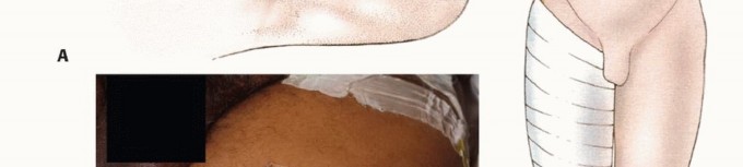 وصف طبي دقيق للمريض