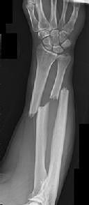 Orthopedic Basic Review | Dr Hutaif Basic Science Revie -...