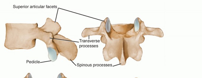 Illustration of spinal canal stenosis - Dr. Mohammed Hutaif
