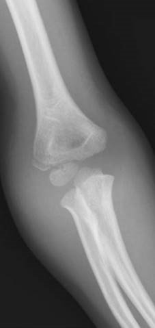 Illustration 19 for Ace Your FRCS: Key Questions in Trauma & Orthopaedics