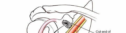 Illustration 26 for Essential Guide: Mastering Every Approach to the Shoulder