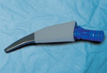 صورة طبية: مفصل الفخذ الصناعي قصير الجذع METHA: حلول مبتكرة للحفاظ على العظم في صنعاء مع الأستاذ الدكتور محمد هطيف