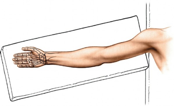 Volar Approach: Optimal Exposure for the Volar aspect of the Distal Radius