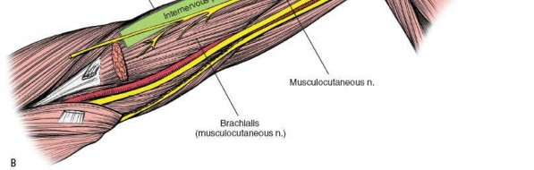 Illustration 7 for Humeral Shaft Anterior Approach: Master Surgical Techniques