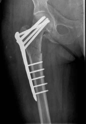Illustration 6 for Lower Limb Trauma: Decipher Anteroposterior (AP) Figure for Exams