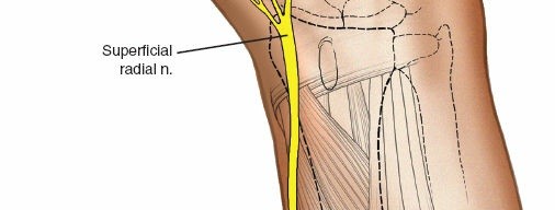 Illustration 7 for Expert Guide: Ulna and Wrist External Fixation Pin Placement