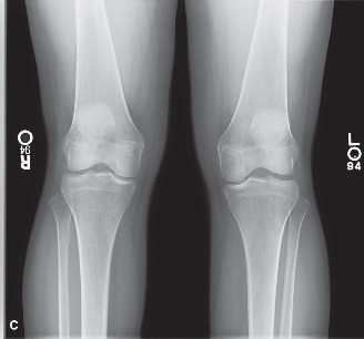 Illustration 2 for Solve Sports Medicine Cases: Uncover Why the Correct Answer Is E