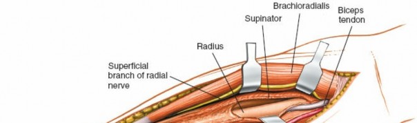 Illustration 19 for Mastering Approaches to the Upper Third of the Radius