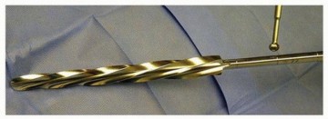 Illustration 2 for Optimizing Revision THA with Tapered Fluted Titanium Stems