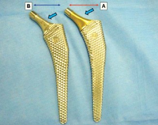 Illustration 2 for Mastering Soft Tissue Balancing for Optimal THR Outcomes