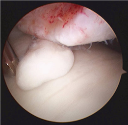 Illustration 25 for First Metatarsal Surgery: Expert Solutions for Foot & Ankle Pain