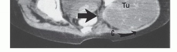 وصف طبي دقيق للمريض