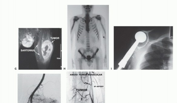 Clinical Image
