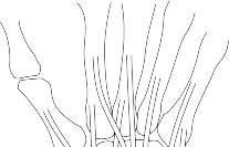 Illustration 17 for Mastering Wrist Surgery: Actions That Must Be Taken for Success