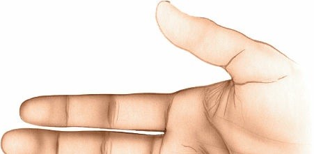 Illustration 206 for Essential Surgical Approaches: Uncover Every Aspect of the Wrist