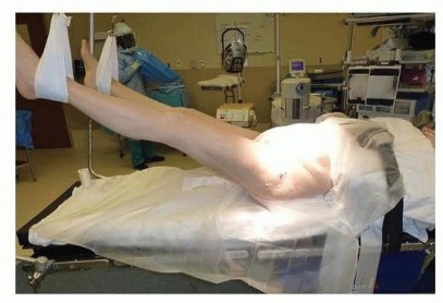 مقارنة بين نصف مفصل الورك والمفصل الكلي