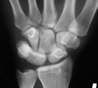 Illustration 20 for Christine M Kleinert Discussion: Solving Difficult Wrist Fractures