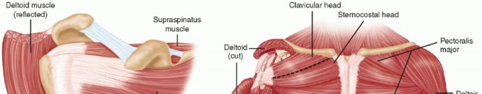 Irreparable Subscapularis Tears? Explore Pectoralis Major Transfer.