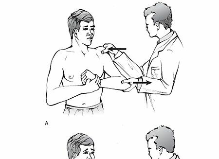 Anterior Glenohumeral Dislocation: Comprehensive Guide to Epidemiology, Anatomy, & Mechanisms