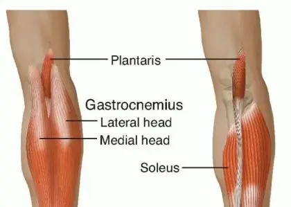 صورة توضيحية لـ تمزق وتر أخيل: دليلك الشامل للعلاج والتعافي مع الأستاذ الدكتور محمد هطيف