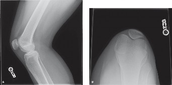Illustration of medicine cases sports medicine - Dr. Mohammed Hutaif