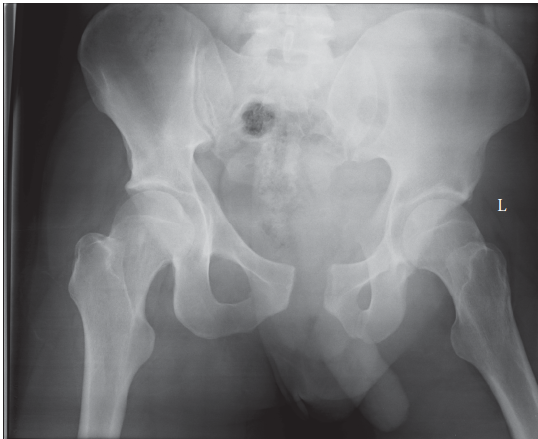 Pelvic Fracture Case: Test Your Knowledge with this Interactive Module