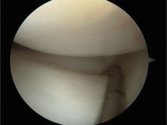 Illustration 5 for Pediatric Pain & Swelling: 16 Cases Solved & Diagnoses Revealed