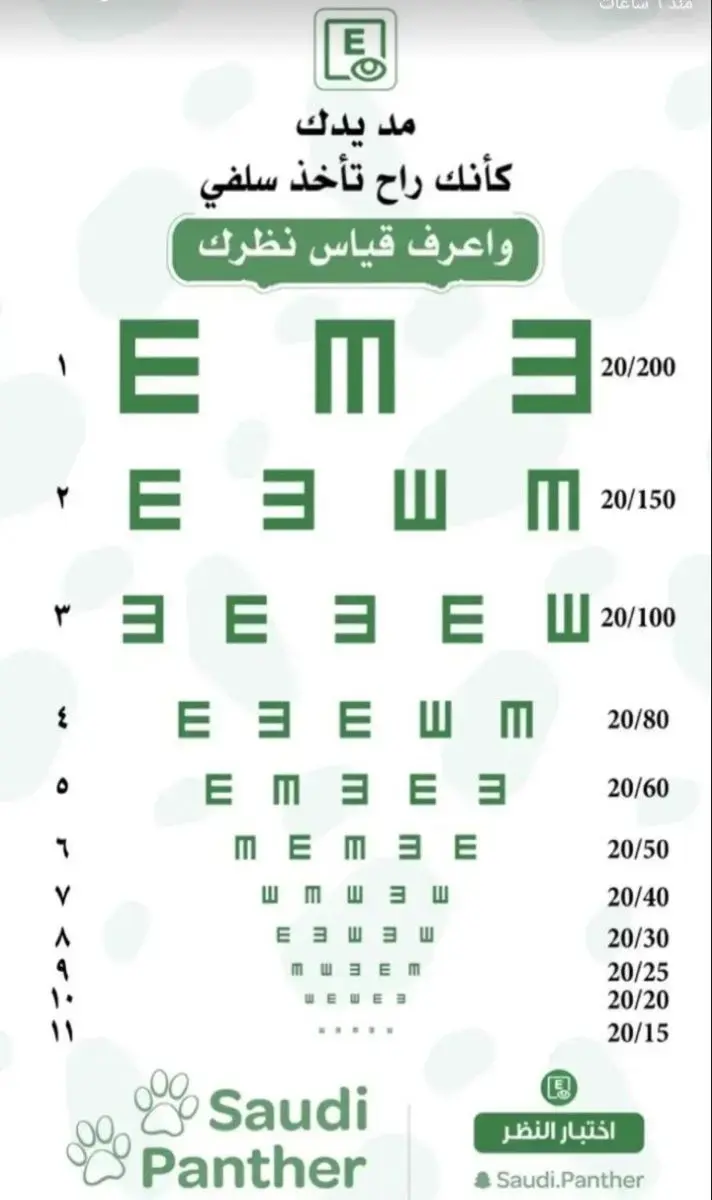 وداعاً لألم الكعب: اكتشف علاج مسمار القدم ومهماز العقب