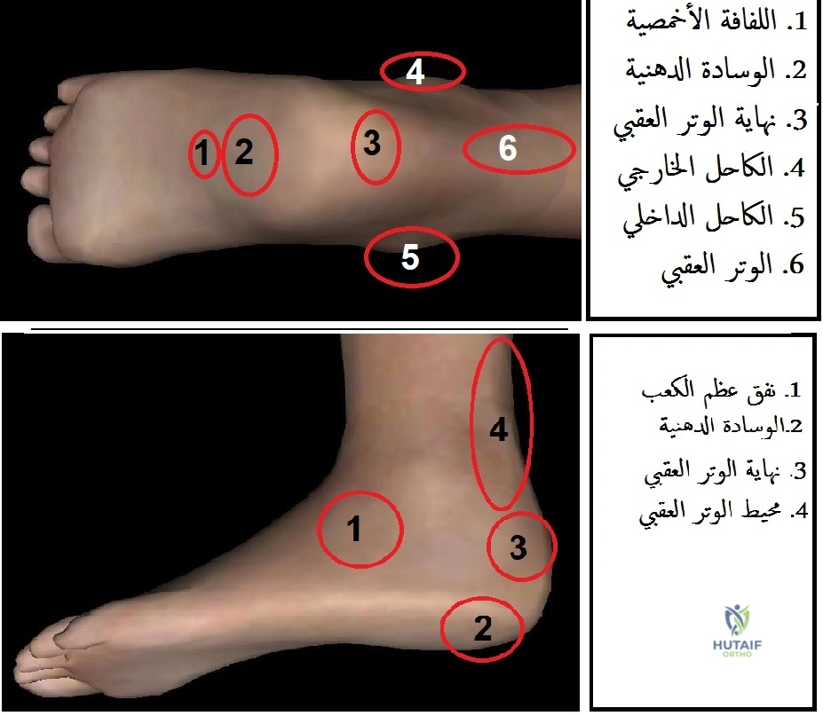 صورة توضيحية 2 لموضوع وداعاً لـ الم القدم والكاحل: الأسباب الخفية، الأعراض، العلاج والوقاية