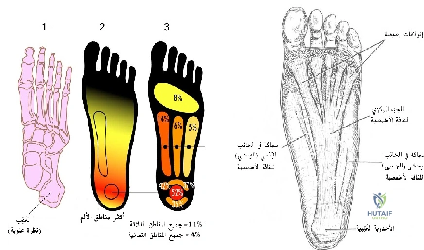 صورة توضيحية 5 لموضوع وداعاً لـ الم القدم والكاحل: الأسباب الخفية، الأعراض، العلاج والوقاية