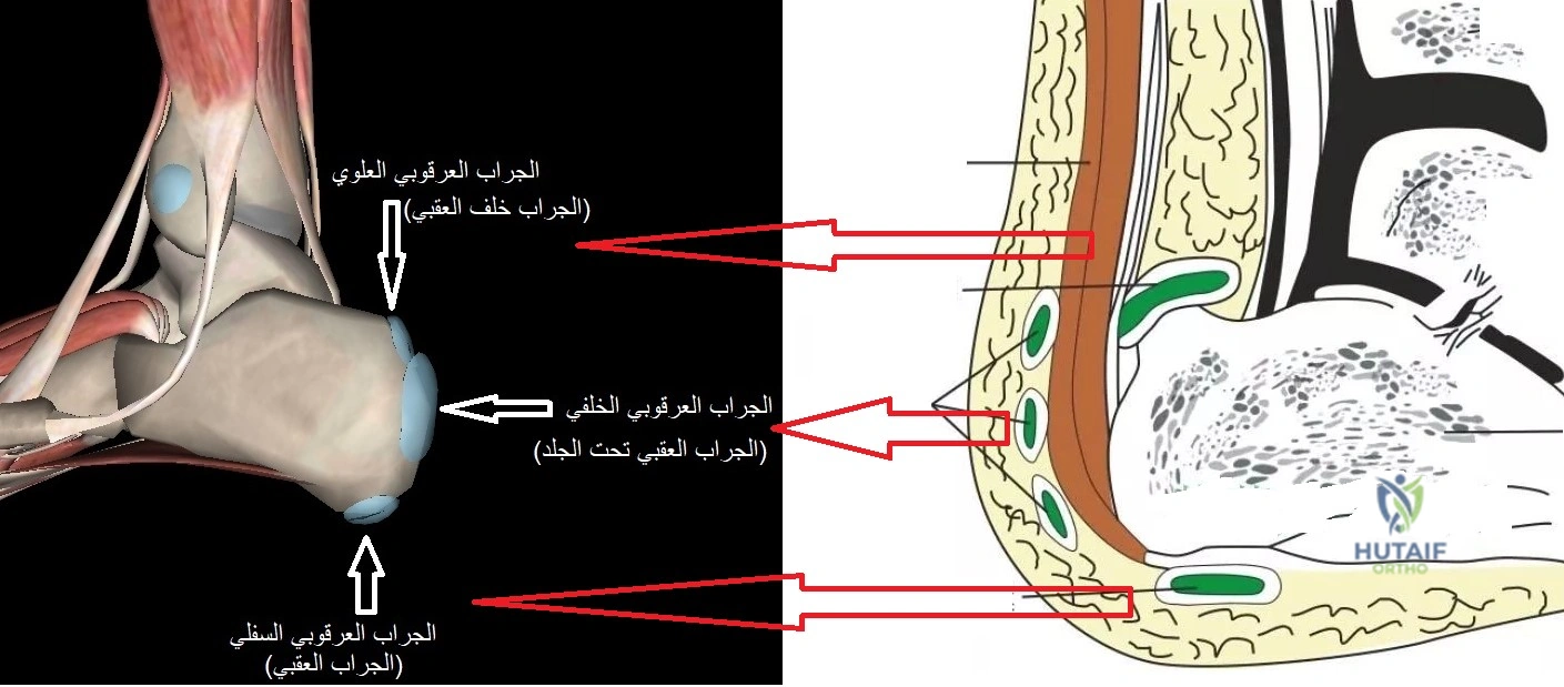 صورة توضيحية 11 لموضوع وداعاً لـ الم القدم والكاحل: الأسباب الخفية، الأعراض، العلاج والوقاية