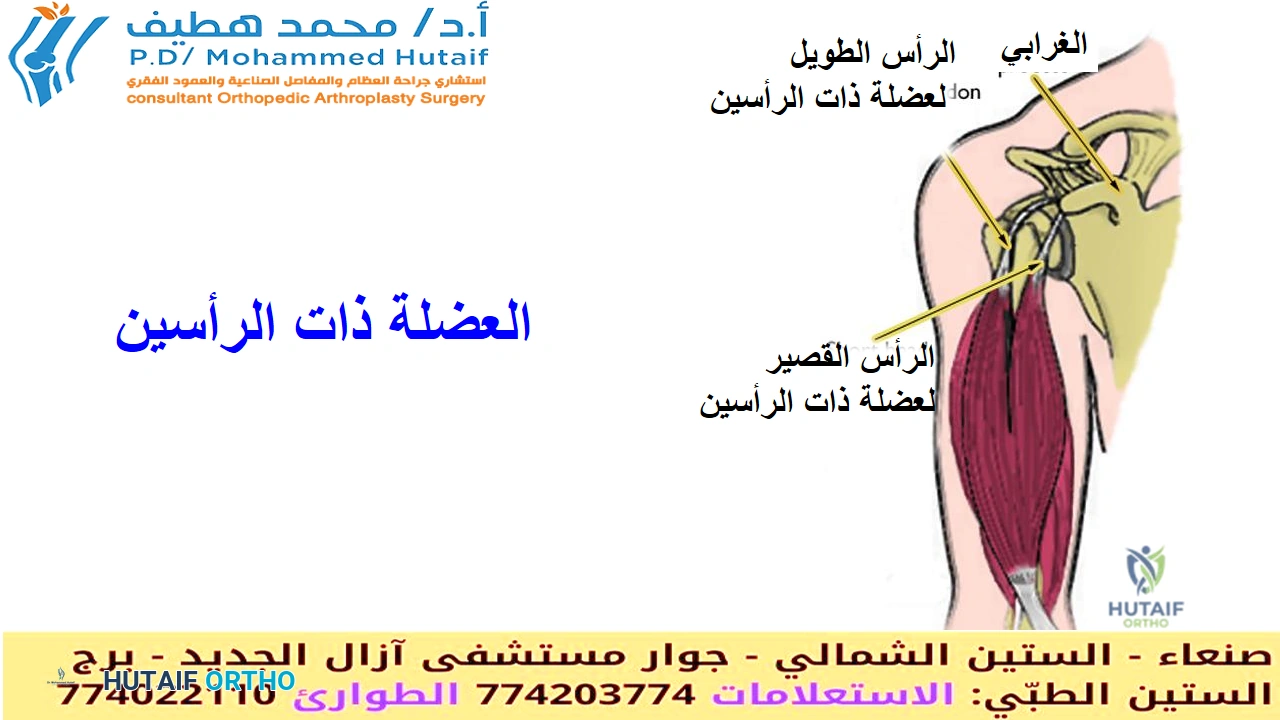 التهاب وتر العضلة ذات الرأسين