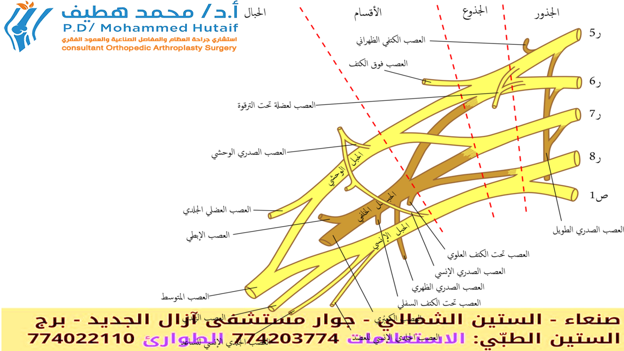 إصابات الضفيرة العضدية
