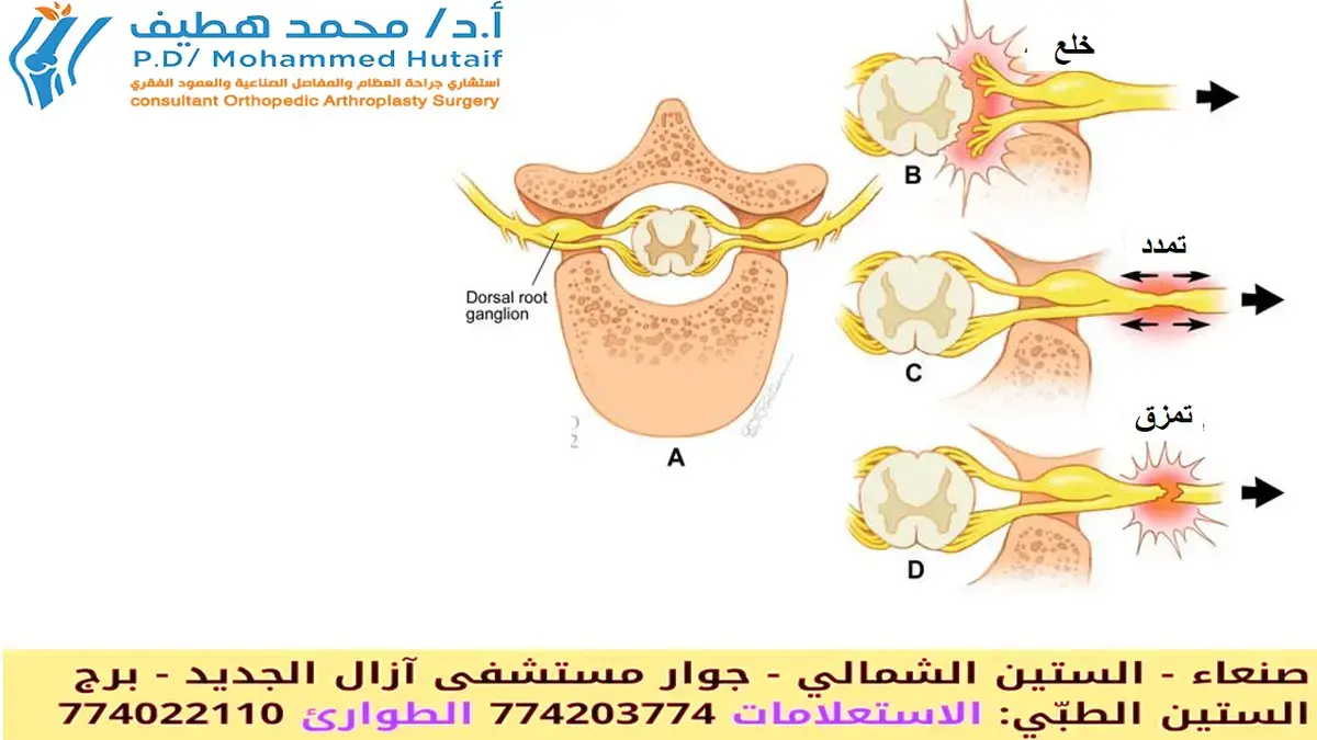 اكتشف: كسر عظم الكعبرة.. دليلك الأمثل لامتحان FRCS!