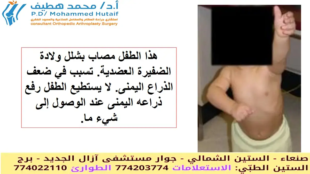 استعد عافيتك: خطتك الشاملة لإصابات العظام والمفاصل