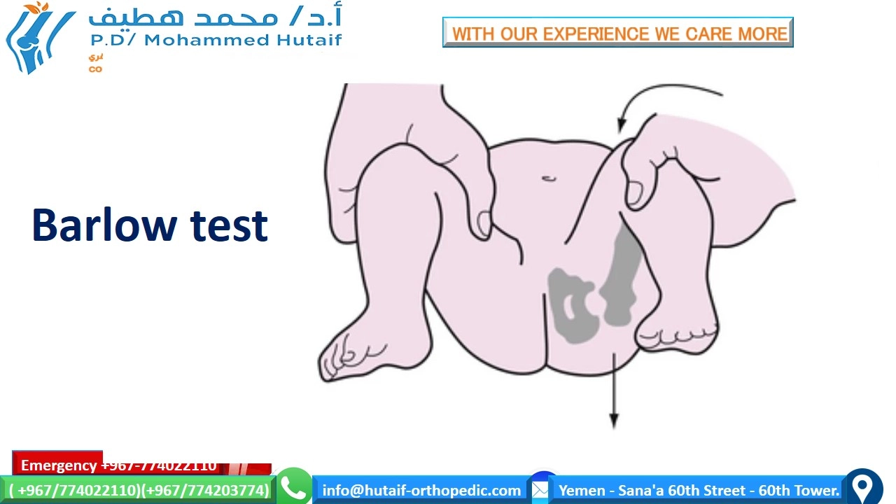 Uncover Hip Dysplasia: Symptoms, Doctor Exam & Differential Diagnosis