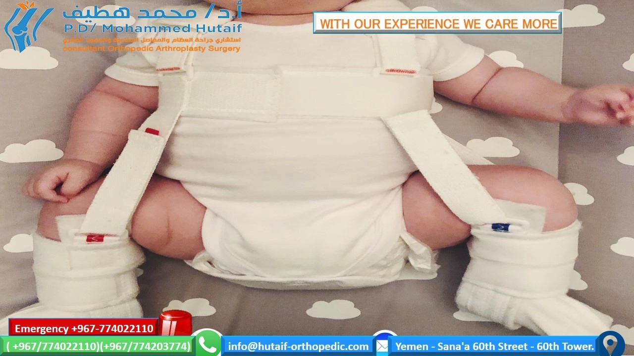 Hip Dysplasia Treatment: Outcomes, Recovery, & Preventing Complications