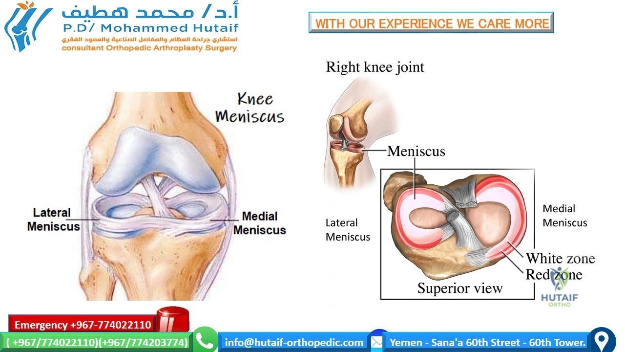 EXCELLENT ORTHOPEDIC DOCTOR YEMEN